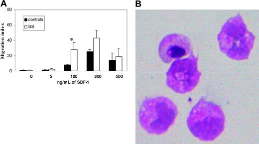 Figure 2. Chemotactic response to SDF-1 of circulating T lymphocytes isolated from SS patients and healthy donors. (A) Chemotactic response of CD4+ SS cells and CD4+ control cells following exposure to increasing concentrations of SDF-1 (5 to 500 ng/mL) with a typical bell-shaped response curve. Results (mean ± SEM from 3 separate experiments) are shown as migration indexes representing the ratio between the number of cells that migrated in the presence of SDF-1 and the number of cells that migrated in response to medium alone. *Significant differences between controls (▪) and SS (□) by the Student t test (controls, n = 4; SS, n = 7; P < .05). (B) Cells that migrated in the lower chambers in response to SDF-1 were collected and stained with hematoxylin-eosin to evaluate their morphologic features. Original magnification × 40.