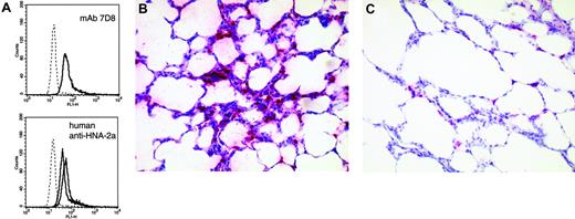 Figure 2. Anti-HNA-2a leads to neutrophil activation and clustering of leukocytes in the capillaries of the lung. (A) Production of ROS as determined by flow cytometry. Left panel shows response to mAb 7D8; right panel shows response to IgG fractions obtained from 2 of 3 analyzed human sera containing anti-HNA-2a. Appropriate controls (murine and human IgG, respectively) are given as histograms with dotted lines. All histograms are representative of 3 independent experiments. (B,C) Clustering of leukocytes in pulmonary capillaries following the administration of anti-HNA-2a (B), but not of control antibody (C). After the final venous pressure elevation, rat lungs were instilled with formaldehyde solution (4.5%, pH 7.2) through the trachea. Fixation was allowed to proceed overnight at room temperature. Subsequently, tissue samples were embedded in paraffin and sections of 5 μm from all lungs were stained with hematoxylin-eosin and antimyeloperoxidase. Pictures are representative for experiments and controls (antimyeloperoxidase, APAAP). A Zeiss Axioskop 40 (Carl Zeiss, Jena, Germany) with Plan-NEO Fluar 20×/0.5 NA objective lenses, in connection with a JVC KY-S75U digital camera (JVC, Friedberg, Germany) was used to acquire the micrographs. Images were processed with Diskus acquisition software, version 4.50 (Hilgers, Königswinter, Germany).