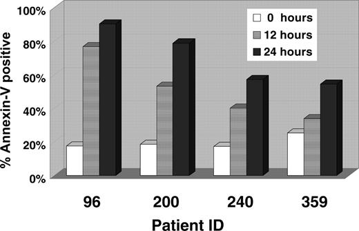 Figure 1. CCI-779 induces apoptosis in a short-term human ALL culture system. A total of 106 lymphoblasts from patients with adult human ALL were aliquoted onto a bone marrow stromal cell layer. All cells were maintained in culture for 24 hours and were either untreated (control) or treated with CCI-779 (100 ng/mL) for 12 or 24 hours. The x-axis depicts patient sample identification, and the y-axis depicts the percentage of apoptotic (annexin V-positive)/CD19-positive cells.
