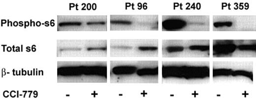 Figure 5. Treatment with MTIs results in hypophosphorylated S6 in ALL. Splenocytes were harvested from mice treated with CCI-779 or control (vehicle). Immunoblot of phospho-S6 (ser235/236) of control and CCI-779 treated (top bands), total S6 (middle bands), and β-tubulin (bottom band; loading control) from 4 patient samples is depicted. We found a correlation between clinical response and biochemical response to CCI-779 in all samples. ALL cells from CCI-779-treated mice had 48% to more than 95% down-regulation of phospho-S6 compared to blasts from control mice.