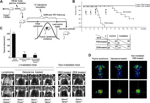 Figure 1. Effect of zebularine on a mouse model of gamma-induced thymic lymphoma determined by overall survival, NMR, and PET. (A) Schematic diagram of the gamma-induced mouse model of lymphomagenesis, zebularine treatment, and NMR and PET imaging follow-up. (B) Up indicates Kaplan-Meier survival curve; γ, gamma irradiation; Tb, start of zebularine treatment; and Te, end of zebularine treatment. Black and gray straight lines show nonirradiated control mice treated with PBS and zebularine (Zeb), respectively; ♦ line shows irradiated and PBS treated animals; and ▪ line shows irradiated and zebularine treated mice. Below, summary of total number of animals used in the study (n) and the surviving animals (alive). (C) Follow-up of thymus and thymic lymphoma sizes by NMR using a Bruker Biospec spectrometer/Magnex 4.7 Teslas 40-cm bore horizontal magnet MRI system. Image analysis and tumor volume measurements were performed with the public domain software ImageJ (NIH, http://rsb.info.nih.gov/ij). A marked volume reduction in the thymic mass is observed in zebularine-treated mice. (D) Metabolic activity in FDG-PET imaging; PET image shows a significant “hot spot” (yellow) confined in the thymic lymphoma that is lost in the zebularine-treated mice.
