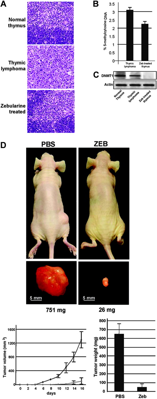 Figure 2. Effect of zebularine on histology, lymphoma xenografts, and DNA methylation parameters. (A) Hematoxylin and eosin (H&E)-stained 4-μm section thymus samples. The pathological findings in the thymus of the zebularine-treated mice resemble the structure of the normal thymus. Images were captured with an Olympus Vanox microscope (Olympus, Melville, NY) using a 10 ×/0.35 NA objective. (B) Analysis of global DNA methylation by high-performance capillary electrophoresis (HPCE). The irradiated thymus of the zebularine-treated mice shows DNA hypomethylation compared with the lymphomas appearing in the irradiated mice that only receive PBS. (C) Western blot analysis of DNMT1 protein levels in normal thymus and lymphomas appearing in the irradiated mice that only receive PBS and in irradiated thymus of the zebularine-treated mice. (D) Top panels show female athymic nude mice 16 days after injection of 106 MOLT-4 cells. Note the large tumor on the left, corresponding to a PBS-treated mouse, and the small tumor on the opposite figure, corresponding to zebularine-treated mouse. Tumor detail is shown in millimeters, and weight is shown in milligrams. Bottom panels show effect of zebularine treatment on the in vivo growth of MOLT-4 cells. Tumor size was monitored over time, and size is shown in cubic millimeters. Tumoral weight data at 16 days with PBS- and zebularine-treated MOLT-4 xenografts presented as means ± SD.