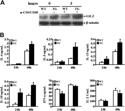 Figure 1. Lymphokine production in CD4+ cells cultured under Th-0 conditions. Naive CD4+ CD62Lhigh T cells were isolated by cell sorter from the spleens of wild-type (WT) and transgenic (TG) littermate mice and stimulated with anti-CD3/anti-CD28 Abs. (A) Protein extracts from freshly naive CD4+ T cells (0 hours) and activated T cells (3 hours) were processed for immunoblot analysis using anti-GILZ Ab. The same extracts were reprobed with anti–β-tubulin Ab. (B) The culture supernatants were collected at 24 and 48 hours and the cytokine concentrations were determined by ELISA. Bars represent the mean values ± 1 SEM of 3 independent experiments. *P < .05 represents significant differences of TG vs WT mice.