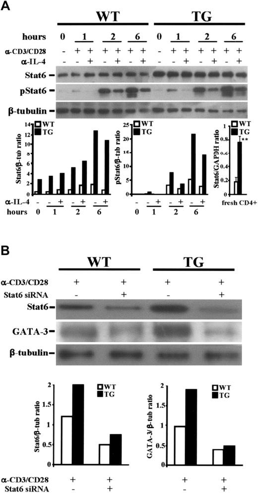 Figure 5. Expression and phosphorylation of Stat6. (A) Naive TG and WT CD4+ CD62Lhigh T cells were cultured with anti-CD3/anti-CD28 Abs in the presence or in absence of anti–IL-4 Ab (10 μg/mL) for the indicated times. Protein extracts were processed for immunoblot analysis using anti-Stat6 Ab (top lane) or anti–phospho-Stat6 (pStat6) (middle lane). Quantitative analysis of Stat6/β-tubulin and pStat6/β-tubulin ratio is shown. Data shown are representative of 2 independent experiments. Quantitative analysis of Stat6/GAPDH, as evaluated by RT-PCR, is shown; bars represent the mean values ± 1 SEM of 2 independent experiments. **P < .01, TG vs WT. (B) CD4+ cells were transfected with siRNAs specific for Stat6 and, 1 hour later, activated by anti-CD3/anti-CD28 Abs for 24 hours. Western blot was analyzed by specific Abs for Stat6 and, after stripping for GATA-3 and β-tubulin. Quantitative analysis of Stat6/β-tubulin and GATA-3/β-tubulin is shown.