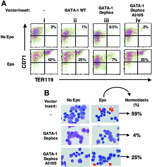 Figure 2. Phosphorylation of GATA-1 is required for fetal liver erythroid cell differentiation. (A) TER 119- fetal liver progenitor cells were transduced with an empty retroviral vector (MIG) or vectors containing the indicated inserts and cultured in the presence or absence of Epo; 36 hours later live GFP+ cells were examined for expression of red cell differentiation markers, percentages of CD71+TER 119+ differentiated cells (top right quadrant) in the absence or presence of Epo are shown. Representative of at least 3 independent experiments. (B) Representative field of Wright-Giemsa staining of live GFP+ cells (× 1000) and of differential count: the percentage of highly mature erythroblasts (normoblasts shown by arrows) formed in Epo-stimulated cultures in indicated GFP+-transduced cell populations is shown. Images were captured with a Nikon E600 microscope (Garden City, NJ) with a 100×/0.3 numeric aperture oil immersion lens and an RT slider SPOT 2.3.1 camera (Diagnostic Instuments, Sterling Heights, MI) using SPOT advanced software (version 3.5.9).