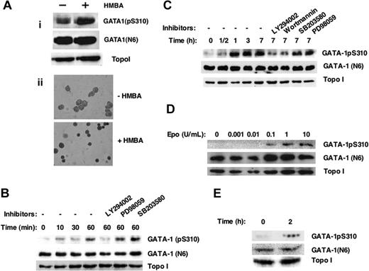 Figure 3. GATA-1S310 is phosphorylated in response to Epo stimulation of primary fetal liver and cultured erythroid cells. (A) Western blot analysis of nuclear extracts of MEL cells induced to differentiate in the presence or absence of 5 mM HMBA after 96 hours using anti-GATA1 (pS310), anti-GATA1 (N6), or anti-topoisomerase I (Topo I) antibodies (i). Benzidine staining of hemoglobin (ii) confirmed the undifferentiated and differentiated status of MEL cells used (i). (B-C) The Epo-dependent erythroleukemic HCD57 cells were Epo-starved overnight, and 5 × 107 cells were stimulated with Epo (2 U/mL) for the indicated time points, in the presence or absence of inhibitors of PI3-kinase LY294002 (LY; 10 μM), Wortmannin (WO; 100 nM), inhibitor of ERK/MAP kinase PD98059 (PD; 50 μM), or inhibitor of p38 MAP kinase SB203580 (SB; 10 μM). Western blot analysis of nuclear extracts with the indicated antibodies. (D) Cells (from B-C) were stimulated with increasing doses of Epo for 1 hour, and nuclear extracts were subjected to Western blot analysis as in panel B. Results shown are representative of at least 3 independent experiments. (E) Fetal liver cells enriched for erythroid progenitors (TER 119- cells) were starved overnight in vitro in serum-free media (SFEM; StemCell Technologies) in the presence of SF (50 ng/mL) and IL-6 (10 ng/mL) and stimulated or not with Epo (2 U/mL) for 2 hours. Nuclear extracts were subjected to Western blot analysis as in panel B.
