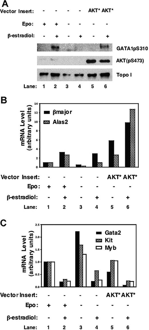 Figure 6. Activated AKT phosphorylates and enhances GATA-1 transactivation activity in erythroid cells. (A) G1E-R2H cells were retrovirally transduced with an empty vector (MIG) or MIG-AKT* and cultured in the presence or absence of Epo for 16 hours before adding β-estradiol (10-7 M). Nuclear extracts were prepared 7 hours later and subjected to Western blot analysis using the indicated antibodies. Total RNA was prepared from an aliquot of cells from panel A and subjected to real-time PCR for analysis of genes whose expression is up-regulated (B) or repressed (C) by nuclear GATA-1. Representative graphs from 3 independent experiments are shown.