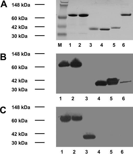 Figure 1. Protein purification and Western blotting of recombinant proteins. Top: SDS-PAGE and Coomassie blue staining. Middle: Western blot using a mouse monoclonal antibody to human TF. Bottom: Western blot using mouse monoclonal antibody to His6. M indicates molecular weight marker. Lanes 1 to 5 are identical in panels A, B, and C: lane 1, sTF-annexin V; lane 2, sTFAA-annexin V; lane 3, annexin V; lane 4, sTF; and lane 5, recombinant TF.18 Lane 6, panel A: bovine serum albumin; panels B and C: recombinant TF (Innovin; Dade Behring).