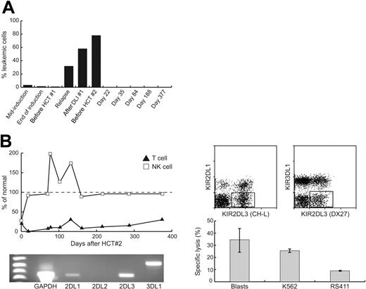Figure 1. Results of first and second HCTs. (A) Quantification of MRD in the bone marrow by flow cytometry. The progressive disease burden seen on relapse after the HCT no. 1 is in contrast to the rapid and sustained disease response following the KIR-mismatched transplantation (HCT no. 2). (B) Flow cytometric evaluation of immune reconstitution after HCT no. 2 showed a rapid NK-cell reconstitution within 3 weeks, whereas T-cell reconstitution remained minimal (the numbers of CD56+CD3- NK cells and CD3+CD56- T cells in each blood sample are shown as the percentage of mean values for 57 healthy children older than 12 months in our institution.) RT-PCR analysis of donor-derived NK cells showed a high level of expression of KIR2DL3; a large subset of KIR2DL3+ KIR2DL1- KIR3DL1- NK cells was revealed by flow cytometric analysis. Natural cytotoxicity of the donor-derived NK cells against the patients' leukemic blast cells was demonstrated in a standard 2-hour assay7 in vitro (mononuclear cell-to-target cell ratio, 40:1). A K562 cell line was used as the standard positive control. RS411 cells, which carried the t(4;11) translocation and expressed all 3 groups of KIR ligands, were used as the negative control.