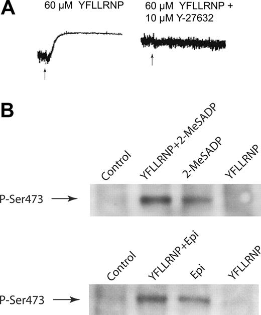 Figure 2. G12/13 signaling potentiates Akt phosphorylation mediated by Gi or Gz signaling in human platelets. (A) Aspirin-treated, washed human platelets preincubated with 10 μM Y-27632 were stimulated with 60 μM YFLLRNP, and platelet aggregation was measured as described in “Materials and methods.” Arrows indicate the addition of agonist. (B) Washed platelets were stimulated at 37°C for 5 minutes with YFLLRNP (60 μM), 2-MeSADP (1 μM), or epinephrine (Epi; 10 μM). Platelets stimulated with 2-MeSADP were preincubated with 10 μM MRS-2179. The addition of YFLLRNP (60 μM) was made as indicated. The reaction was stopped by the addition of 3 × SDS sample buffer. Samples were separated by SDS-PAGE, Western blotted, and probed with anti-phospho-Akt (Ser473) antibody. The data shown are representative of 3 experiments.