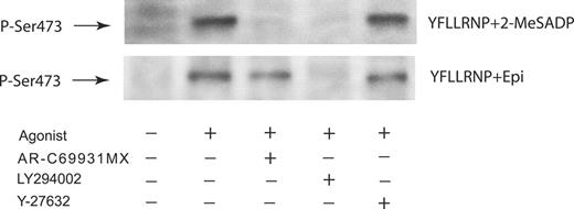 Figure 3. Role of Rho kinase in Akt phosphorylation induced by combined G12/13 and Gi/Gz signaling in platelets. Washed platelets preincubated with 1 μM AR-C69931MX, 25 μM LY294002, or 10 μM Y-27632 were stimulated at 37°C for 5 minutes with either YFLLRNP (60 μM) + 2-MeSADP (1 μM) or YFLLRNP (60 μM) + epinephrine (10 μM). Platelets stimulated with 2-MeSADP were preincubated with 10 μM MRS-2179. The reaction was stopped by the addition of 3 × SDS sample buffer. Equal amounts of proteins were analyzed by Western blot analysis with anti-Ser(P)473 antibody. The Western blot analysis shown is a representative of 3 independent experiments.