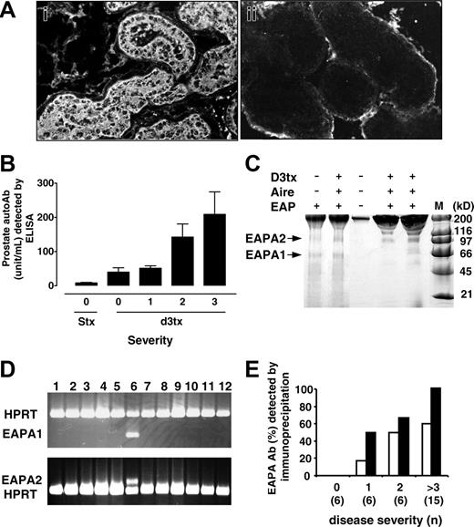 Figure 1. Identification of prostate autoAgs by autoAb from d3tx male B6AF1 mice with EAP. (A) Cytoplasmic Ag is detected by indirect immunofluorescence in anterior prostate lobe with serum IgG autoAb from d3tx mice with EAP (i; original magnification × 200). The reaction of serum from a d3tx mouse without EAP is shown in panel ii as a negative control (original magnification × 200). Histological studies were done using an Olympus BH2 microscope (Olympus, Melville, NY), and pictures were taken with an Olympus DP12 digital microscope camera. Images were taken with 20×/__ NA (panels __) and 40×/__ NA (panels __) objectives. (B) Correlation between EAP severity and level of serum autoAb to anterior prostate extract detected by enzyme-linked immunosorbent assay (ELISA) as arbitrary units. STx indicates sham thymectomized mice. (C) Two protein bands with molecular weight of 68 kDa and 110 kDa (EAPA1 and EAPA2, respectively) in B6AF1 anterior prostate extract were immunoprecipitated by serum autoAb from d3tx mice and the aire knockout mice with EAP, detected by SDS-PAGE. (D) Prostate-specific expression of EAPA1 and EAPA2 is determined by RT-PCR. Lane 6 contains prostate RNA, whereas the lanes with negative result contain RNA of kidney, stomach, lung, brain, testis, muscle, spleen, liver, heart, pancreas, and thymus. (E) The incidence of serum autoAb that immunoprecipitated EAPA1 (□) and EAPA2 (▪) correlated with EAP severity of d3tx mice, and EAPA2 Ab is detected more frequently.