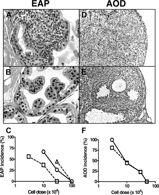 Figure 2. Histopathology of AOD and EAP in d3tx B6AF1 mice and comparison of suppression of the 2 autoimmune diseases by Tregs. (A) Prostatitis with lymphocytic infiltration in a d3tx mouse. (B) Normal anterior prostate of a d3tx mouse suppressed with 3 × 105 male Tregs. (D) Severe oophoritis in a d3tx female mouse, with heavy inflammatory infiltrate and oocyte loss. (E) Normal ovary of a d3tx mouse suppressed by 5 × 105 Tregs from normal female donors. Original magnification × 400 (A-B) and × 200 (D-E); hematoxylin and eosin. Histological studies were done using an Olympus BH2 microscope (Olympus, Melville, NY), and pictures were taken with an Olympus DP12 digital microscope camera. Images were taken with 20×/__ NA (panels __) and 40×/__ NA (panels __) objectives. (C) The cell dose response of EAP suppression by Tregs from male (□), female (○), and NOr male (▵) donors. (F) The cell dose response of AOD suppression by Tregs from male (□) and female (○) donors.