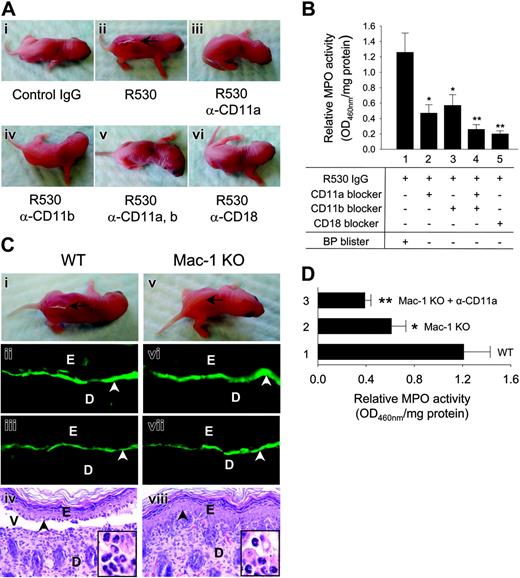 Figure 1. LFA-1 and Mac-1 are involved in experimental BP. WT and Mac-1 KO mice were pretreated with PBS or β2 integrin-neutralizing antibody and 2 hours later were injected intradermally with control or pathogenic IgG R530. The mice were examined 24 hours after R530 injection. (A) WT mice injected with R530 (ii), but not injected with control (i) or pretreated with antibody against CD11a (iii), CD11b (iv), both CD11a and CD11b (v), or CD18 (vi) showed no skin lesions. (B) MPO assay showed significantly higher levels of neutrophil infiltration in WT mice (bar 1) than WT mice pretreated with antibody against CD11a (bar 2), CD11b (bar 3), both CD11a and CD11b (bar 4), or CD18 (bar 5). Data shown are the mean ± SEM. n = 8 for each group. (C) R530-injected WT mice developed skin blisters and showed linear deposition of rabbit IgG (ii) and mouse C3 (iii) at the BMZ by direct IF. H&E-stained section from these mice revealed a subepidermal vesicle with neutrophilic infiltrate (iv, inset). In contrast, R530-injected Mac-1 KO mice showed no clinical (v) nor histological (viii) blisters, although direct IF showed rabbit IgG and mouse C3 deposition at the BMZ (vi-vii). Position of the skin lesion (arrow), site of basal keratinocytes (arrowhead), dermis (D), epidermis (E), vesicle (V) (original magnification, × 200). Higher magnifications of H&E-stained sections exhibit infiltrating neutrophils in the dermis (insets), original magnification, × 920. (D) MPO assay revealed a significant decrease in neutrophil accumulation in Mac-1 KO (bar 2) and Mac-1 KO mice pretreated with anti-CD11a antibody (bar 3) compared with WT mice (bar 1). Data shown are the mean ± SEM. n = 9. *P < .01; **P < .001. P < .05 (bar 2 vs bar 3).