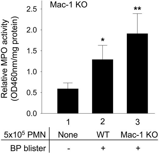 Figure 4. In vivo reconstitution of neutrophils at the tissue site restores experimental BP in Mac-1-deficient mice. Mac-1 KO mice were injected intradermally with either pathogenic anti-mBP180 IgG R530 alone (bar 1), pathogenic IgG plus 5 × 105 WT (bar 2), or Mac-1 KO neutrophils (bar 3). The animals were examined 24 hours after IgG injection. The Mac-1 KO mice reconstituted with neutrophils from WT (bar 2) or Mac-1 KO mice (bar 3) developed blisters and the lesional skin of the diseased mice had a significantly higher number of neutrophils than the nonlesional skin of the Mac-1 KO mice without neutrophil reconstitution (bar 1). Data shown are the mean ± SEM. n = 6 for each group. *P < .05 (bar 1 vs bar 2; bar 2 vs bar 3); **P < .001 (bar 1 vs bar 3).