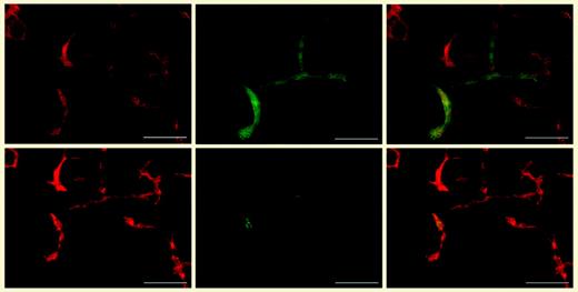 Development of lymphatic endothelial cells in embryoid bodies. Differential immunofluorescence stains for CD31 (red; leftmost panels) and LYVE-1 (green; top middle panel) revealed that the CD31+/LYVE-1+ lymphatic vessels also expressed Prox-1 (green; bottom middle panel). Merged images appear in the rightmost panels. See the complete figure in the article beginning on page 1214.