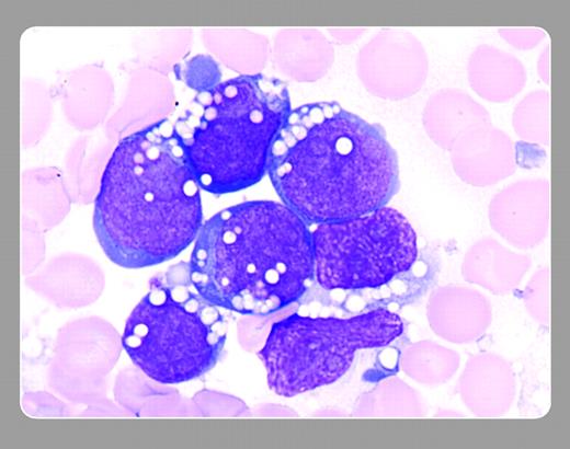 Peter Maslak, Memorial Sloan-Kettering Cancer Center