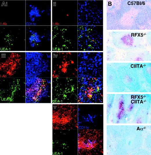 Figure 4. MHCII expression in thymus and spleen of MHCII-deficient mouse strains. (A) Thymic sections from Aα-/- (i), CIITA-/- (ii), RFX5-/- (iii), C/R-/- (iv), and C57BL/6 (v) mice were analyzed by 3-color immunofluorescence staining and confocal microscopy. Medullary regions of the sections are shown. The sections were stained for I-Ab (red; top left quadrants), CD11c (blue; top right quadrants), and UEA-1 (green; bottom left quadrants); bottom right quadrants show overlay of all 3 stains (UEA+I-Ab+ cells = yellow; CD11c+I-Ab+ cells = pink; triple-positive cells = white). (B) Immunohistochemical analysis of I-Ab (red) and B220 (blue) expression on splenic sections of the different mouse strains. Staining for I-Ab (red) in splenic T-cell zones was consistently stronger in RFX5-/- and CR-/- mice than in the C57BL/6 control (see also Clausen et al33).