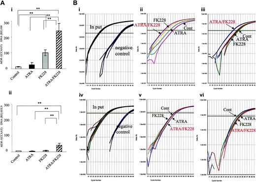 Figure 3. ATRA/FK228 increase H4 and H3-Lys9 acetylation in the MDR1 promoter (CCAAT region) in NB4 cells. (A) The data shown are derived from TaqMan PCR analyses of ChIP assays, as described in “Chromatin immunoprecipitation assay.” Chromatin from NB4 cells treated with ATRA (1.0 μM) and/or FK228 (3.0 nM) for 24 hours was immunoprecipitated with an antibody against acetylated H4 (i) and H3-Lys9 (ii) and analyzed by TaqMan PCR using probes and primers corresponding to the MDR1 promoter (CCAAT region). The graph shows the mean ± SD of representative data from 3 independent ChIP assays. A statistically significant difference was determined by ANOVA and Fisher post hoc tests (**P < .05). (B) Real-time TaqMan PCR profiles of MDR1 promoter (CCAAT region) amplification shown by examples of ChIP assays. (i) The input curve shows the total genomic DNA before immunoprecipitation. The negative control curve shows the results of chromatin immunoprecipitations using PBS. Representative profiles of acetylated H4 (ii) and H3-Lys9 (iii) are shown by examples. (iv-vi) Real-time TaqMan PCR profiles of ANXA1 promoter amplification in the same sample of subpanels i-iii shown as a negative control for ChIP assays. (iv) Input and negative control, (v) acetylated H4, (vi) acetylated H3-Lys9.