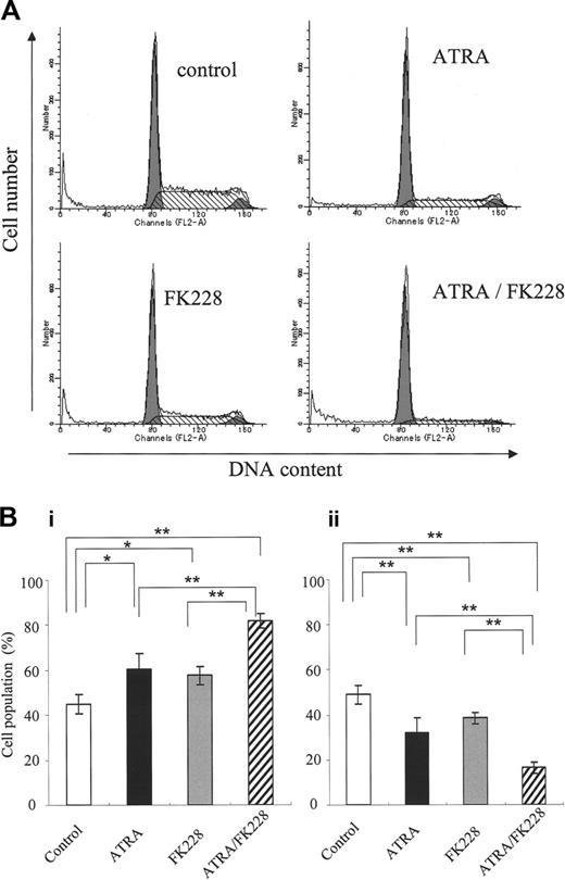 Figure 6. ATRA/FK228 induces G0/G1 cell-cycle arrest in NB4 cells. (A) Example of flow cytometric cell-cycle analysis with PI stain of NB4 cells treated with ATRA (1 μM) and/or FK228 (3.0 nM) for 72 hours, as described in “Flow cytometric analysis.” (B) Graphs show the mean ± SD of data of G1-phase cell population (i) and S-phase cell population (ii) from 3 independent experiments. A statistically significant difference was determined by ANOVA and Fisher post hoc tests (*P < .05; **P < .01).