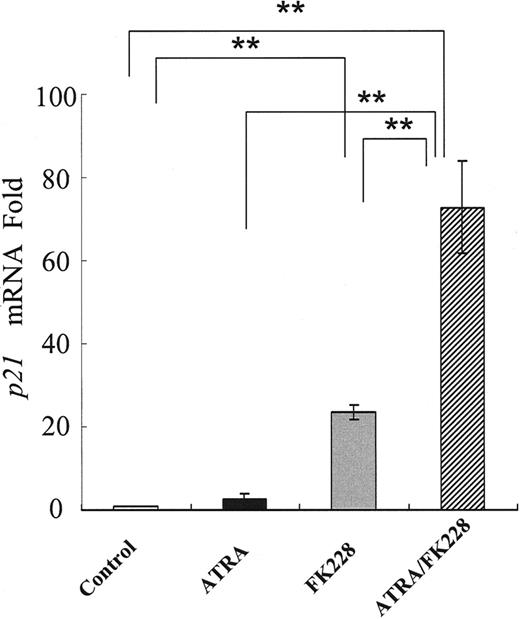 Figure 7. ATRA and FK228 induce p21 mRNA in NB4 cells. Induction of p21 mRNA expression in NB4 cells treated with ATRA (1.0 μM) and/or FK228 (3.0 nM) for 24 hours analyzed by TaqMan RT-PCR analysis. The p21 mRNA expression in each sample was normalized to B2M mRNA expression. Control NB4 cells were used as the calibrator (p21 mRNA level in control NB4 cells = 1). Graphs show the mean ± SD of results from more than 3 independent experiments. A statistically significant difference was determined by ANOVA and Fisher post hoc tests (**P < .01).