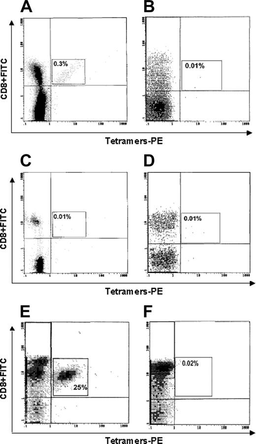 Figure 4. Flow cytometry analysis of binding of p540+ tetramers to circulating CD8+ T lymphocytes. Lymphocytes were from (A) 1 HLA-A2+ cancer patient (no. 1); (B) 1 HLA-A2- cancer patient (no. 17); (C) 1 HLA-A2+ healthy subject; (D) 1 HLA-A2- healthy subject; (E) 1 p540-specific CTL line (generated from patient no. 16 and used as positive control); and (F) 1 EBV-specific CTL line (used as further negative control).