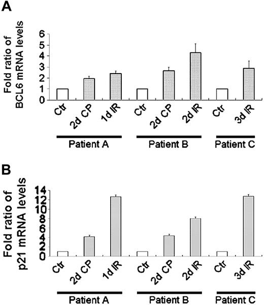 Figure 6. BCL6 mRNA increases after chemotherapy/radiotherapy in human patients. BCL6 (A) and p21 (B) mRNA levels in WBCs taken from patients treated with chemotherapy/radiotherapy were determined using QPCR and normalized to β2-microglobulin. Results display mean ± SD of quantifications repeated 3 times, each in triplicate. Labels adjacent to the x-axis indicate the time in which the PB was taken. Fold ratios of mRNA levels were calculated in comparison to the control samples for each patient. Ctr indicates control; d, number of days of the detailed treatment; CP, cyclophosphamide; IR, whole body irradiation; patient A, a 23-year-old female with prolymphocytic leukemia; patient B, a 29-year-old male with T-ALL; patient C, a 39-year-old female with Philadelphia-positive ALL. □ indicates control.
