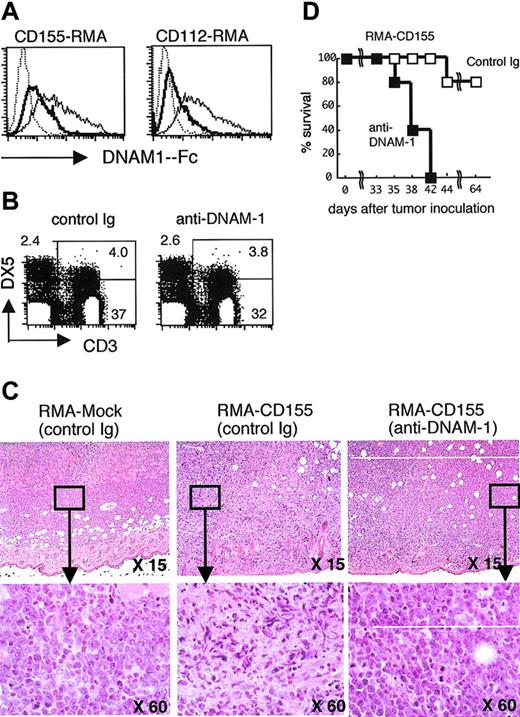 Figure 3. DNAM-1 is involved in rejection of DNAM-1 ligand-expressing RMA tumor cells. (A) CD155-RMA and CD112-RMA were stained with DNAM-1-Fc chimeric protein, which had been incubated with an excess of TX42 mAb (bold line) or control IgG (thin line), and then analyzed by flow cytometry. Staining with control human IgG1 (dotted line) and blocking of the DNAM-1-Fc staining with an excess of TX42 mAb or control IgG was performed to show the inhibitory function of TX42 mAb for DNAM-1 ligand recognition. (B) Splenocytes from mice were stained with FITC-conjugated anti-CD3 and PE-conjugated DX5 and analyzed 7 days after injection with TX42 mAb (200 μg intraperitoneally on day 1 and day 3) by flow cytometry. (C) Groups of 5 C57BL /6 mice were pretreated with control immunoglobulin or anti–DNAM-1 mAb at day -1. The mice were inoculated subcutaneously in the back at day 0 with 1 × 105 mock-transduced RMA tumor cells or Cd155-transduced RMA tumor cells. The skin regions were subjected to histologic analysis with hematoxylin-eosin under light microscopy at day 8. Data are representative of 3 mice in each group. (D) Survival data for 5 mice per group are shown.
