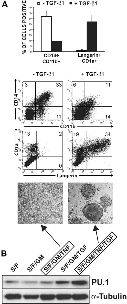 Figure 1. Regulation of endogenous PU.1 protein levels during TGF-β1-induced LC differentiation in serum-free medium. (A) Fluorescence-activated cell sorter (FACS) diagrams show representative CD34+ cells stimulated with “LC mix” (right, TGF-β1 plus SCF, Flt3L, GM-CSF, and TNFα) or LC mix without TGF-β1 (left) for 9 days analyzed for CD11b versus CD14 or Langerin versus CD1a. Bar diagrams represent the means and SEM of 4 independent experiments. The differences between -TGF-β1 and +TGF-β1 were significant (P = .022 for CD14+CD11b+, P = .020 for Langerin+CD1abright, paired 2-tailed t test). Microphotographs show typical LC cluster morphology by cells generated in LC mix (right). TGF-β1-nonsupplemented parallel cultures are compared (left). (B) The Western blot shows endogenous PU.1 or α-tubulin protein levels by CD34+ cells after 72-hour stimulation with the indicated cytokines. Lane 3 (center) and lane 5 (right) represent growth conditions giving rise to cells shown in the left and right FACS diagrams in panel A, respectively. Numbers in the quadrants of each diagram represent the percentage of cells in that quadrant. Data in panel A are representative of 5 independent experiments. Data in panel B are representative of 3 independent experiments. Cytokines: S indicates SCF (20 ng/mL); F, Flt3L (50 ng/mL); GM, GM-CSF (200 ng/mL); TNF, TNFα (2.5 ng/mL); and TGF, TGF-β1 (0.5 ng/mL).