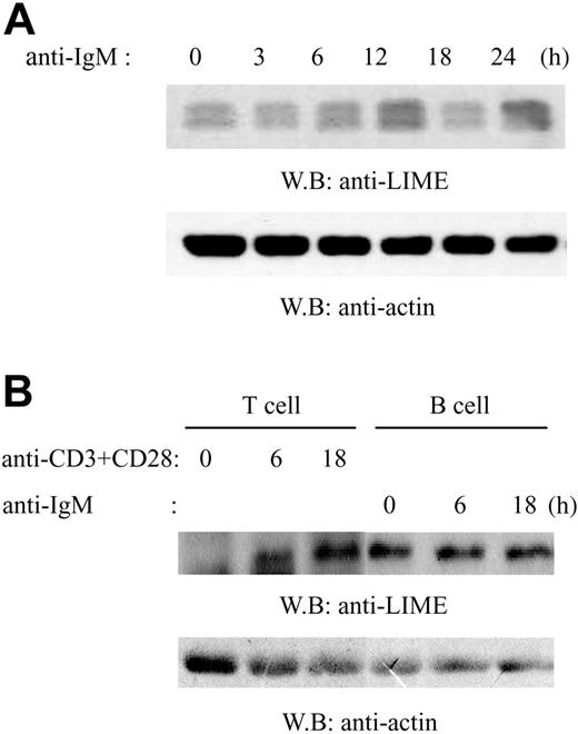 Figure 1. LIME expression in primary mouse splenic B cells. (A) Splenic B cells were isolated from C57BL/6 mice using anti-B220 (CD45R) microbeads. Cells were activated by F(ab′)2 goat anti-mouse IgM for 0, 3, 6, 12, 18, or 24 hours and then lysed. Lysates were analyzed by immunoblotting with mouse polyclonal anti-LIME or antiactin Abs. (B) Splenic T cells were isolated from C57BL/6 mice using anti-Thy1.2 microbeads. T cells were activated by anti-CD3 and CD28 Ab. B cells were purified and activated as described in panel A. Lysates were analyzed by immunoblotting with rabbit polyclonal anti-LIME or antiactin Abs.