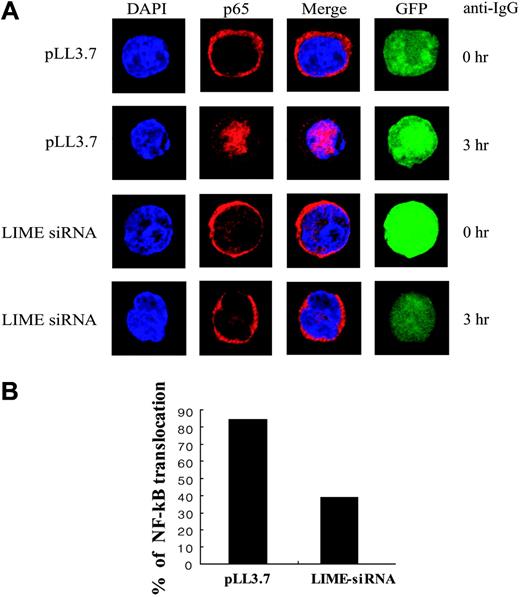 Figure 6. LIME is required for BCR-dependent NF-κB translocation. (A) LIME mediates BCR-dependent NF-κB translocation to the nucleus. A20 cells were transfected with pLL3.7 plasmids or pLL3.7 expressing siRNA against LIME. After 48 hours, transfected cells were activated with 20 μg/mL F(ab′)2 goat anti-mouse IgG for 3 hours at 37°C. The cells were fixed and permeabilized with 0.1% Triton X-100, after which the localization of NF-κB was detected by an anti-p65 Ab and Alexa 568-conjugated anti-rabbit IgG. (B) Graph shows the number of cells with nuclear translocation of NF-κB.