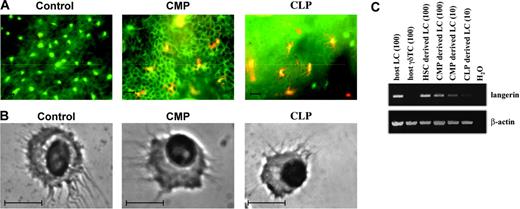 Figure 4. Morphology of CLP- and CMP-derived LCs. (A) Immunofluorescence staining with anti-CD45.1-PE and anti-I-Ab-FITC of epidermal sheets prepared from mice 3 months after transplantation and UV light exposure with either 104 CD45.1 CMPs or 104 CD45.1 CLPs. Epidermal sheets from CD45.2 mice that received transplants of only autologous BM cells served as controls. Scale bar: 10 μm. (B) Cytospin preparations of sorted CMP- or CLP-derived LCs. Sorted CD45.1+/I-Ab+/CD11c+/B220-/TCRγδ- epidermal cells derived from mice that received transplants of either CMPs or CLPs at 3 months after transfer were spun onto glass slides and stained with Wright solution. Scale bar: 10 μm. (C) RT-PCR analysis of Cd207 expression in sorted CD45.1+/I-Ab+/CD11c+/B220-/TCRγδ- epidermal cells. c-DNA was prepared at 4 weeks after transplantation from mice reconstituted with either 104 CD45.1 CMPs or 104 CD45.1 CLPs. cDNAs from LC numbers used per PCR reaction are given in brackets. Actb primers acted as controls. Data are based on at least 2 experiments with similar results.