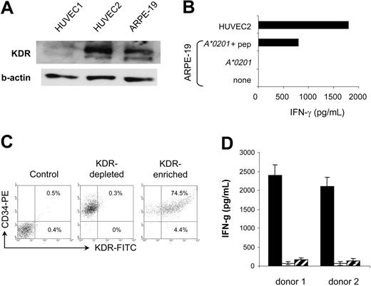 Figure 6. Evaluation of the recognition of KDR+ HRPEpic and CD34+ cells by K288.E5. (A) KDR expression by ARPE-19 cells was determined in Western blot. Two HUVEC-cell lysates were used as positive controls. The β-actin control is shown for each extract. (B) Failure of K288.E5 to recognize ARPE-19 cells transfected with the HLA-A2 gene. In contrast, efficient T-cell recognition was observed on peptide-pulsed cells (10 μg/mL). Recognition of HUVEC2 cells is also shown for comparison. (C) KDR expression by ex vivo selected human cord blood CD34+ cells analyzed by flow cytometry. Percentages represent the number of KDR+ cells in anti-KDR scFv-enriched and -depleted CD34+ cell fractions. Results from 1 of 2 representative A*0201+ donors are shown. (D) HLA class 1-restricted recognition of KDR+CD34+ cells by K288.E5. KDR scFv-enriched (▪) or -depleted () CD34+ cells (1 × 104/well) were cocultured overnight with CTLs (2 × 104/well) in the presence (□) or absence of W6/32 (20 μg/mL). IFN-γ released in culture supernatants was determined by IFN-γ ELISA. Each value represents the mean ± SD of 6 cultures from 2 different experiments.