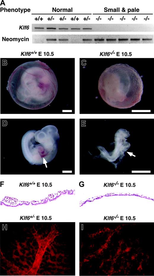 Figure 2. Comparison of Klf6-/-, Klf6+/-, and Klf6+/+ embryos. (A) Ten random E 10.5 embryos derived from Klf6+/- × Klf6+/- crosses were classified according to size and color and genotypes by PCR for Klf6 and neomycin. Klf6-/- embryos are small and pale (see also E-F), whereas no significant differences were detected between Klf6+/- and Klf6+/+ embryos. Compared with the appearance at E 10.5 of the Klf6+/+ yolk sac (B) and embryo (D), Klf6-/- yolk sac (C) and embryos (E) are smaller and paler, and vascular structures in the Klf6-/- yolk sac are poorly developed. The Klf6-/- embryo lacks a definable liver (arrow), although a beating heart was observed at the time of death (not shown). (Scale: bar = 1 mm.) Sections of yolk sacs reveal that Klf6-/- yolk sacs (G) have fewer hematopoietic cells than Klf6+/+ yolk sacs (F). Whole-mount immunohistochemistry of yolk sacs using anti-PECAM1 demonstrates that vascular formation in Klf6-/- yolk sacs (I) is much less organized than KLlf6+/- yolk sacs (H), while expression of PECAM1 is apparent. Images in Figure 2B-E were obtained using a Leica MZ APO stereomicroscope (Leica Microsystems, Bannockburn, IL) equipped with a 1 ×/0.09 objective lens at 12 × (B,D) or 25 × (C,E) total original mangification. A Sony 3CCD DXC-970MD camera (Sony, New York, NY) and NIH Scion public domain software (National Institutes of Health, Bethesda, MD) were used to photograph and capture images. Images in Figure 2F-I were obtained using a Nikon Eclipse E300 microscope equipped with a 40 ×/0.75 objective lens (Nikon Instruments, Melville, NY); they were photographed with a Spot RT Slider camera and then processed with Spot Image Capture for Mac OS 3.5.4 software (Diagnostic Instruments, Sterling Heights, MI).
