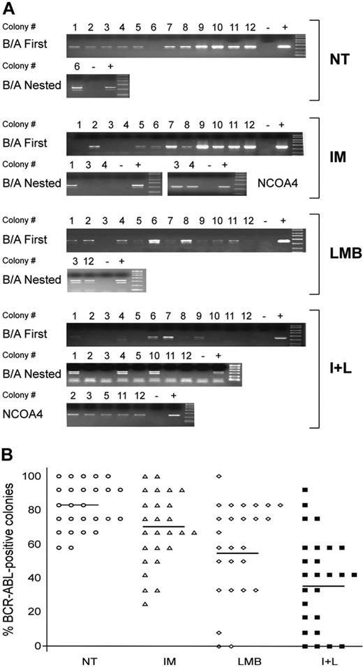 Figure 3. Assessment of BCR-ABL expression in leukemic colonies grown in different experimental conditions. In 26 of the 35 patients reported in Table 4 we randomly selected 48 single colonies (12 for each treatment condition). (A) RNA extracted from each colony was used to perform a 1-step RT-PCR for BCR-ABL. Negative RT-PCR reactions were subjected to a nested PCR for BCR-ABL. Colonies that again scored negative were further analyzed for the ubiquitously expressed gene NCOA4 to verify the quality of the RNA obtained. Each PCR reaction included a negative (-) and positive (+) control. One representative patient (UPN 30) is shown here. (B) Average number of BCR-ABL-positive colonies in the 4 experimental conditions (NT is represented by ○; IM, ▵; LMB, ⋄; and I+L, ▪). Data are presented as percentage of variations with 12 positive colonies set at 100%. Horizontal bars indicate the average number of BCR-ABL-positive colonies in each experimental condition.