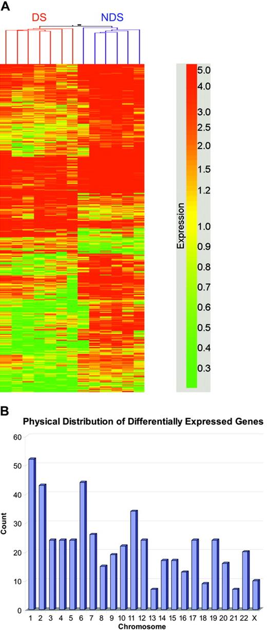 Figure 2. Cluster analysis of differentially expressed genes between DS and non-DS megakaryoblasts; chromosomal localization of genes in cluster analysis. (A) Microarray analysis using the Affymetrix U133A genechip was performed with DS (n = 5) and non-DS (n = 5) AMkL samples and clinically relevant AMkL cell lines (n = 3). Following selection of genes that were present or marginal in either group and filtered for those transcripts with a minimum 2-fold change in expression between DS AMkL and non-DS AMkL, one-way analysis of variance (ANOVA) was used with the Benjamini and Hochberg multiple test correction to control the FDR at 10%, and identified 551 genes as differentially expressed between DS AMkL and non-DS AMkL. Clustering was performed using the median normalized expression data with a Euclidean distance metric and identified 105 genes overexpressed in the DS group and 447 genes overexpressed in the non-DS group. (B) Chromosome localization of the 551 genes analyzed in the cluster analysis.