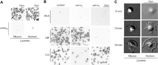 Figure 1. Adhesion and spreading of human and mouse platelets on laminin. (A) Washed murine platelets (3 × 107/mL; left column) or washed human platelets (2 × 107/mL; right column) were pretreated with 1 mM GRGDS peptide in the presence (bottom row) or absence (top row) of 20 μg/mL anti–integrin α6β1 antibody. Coverslips were coated with 50 μg/mL laminin from human placenta overnight at 4°C and then blocked with 1% fatty acid–free BSA for 2 hours at 4°C. After rinsing with Tyrode buffer, platelets were seeded on the coverslips and incubated at room temperature. After 30 minutes of incubation, unbound platelets were removed and adherent platelets were fixed by 3% paraformaldehyde, permeabilized with 0.3% Triton X-100, and F-actin stained using TRITC-labeled phalloidin. After F-actin staining, platelets were visualized using confocal fluorescent microscopy. (B) Murine platelets, washed as described in “Materials and methods” (3 × 107/mL), were pretreated with or without 20 μg/mL anti–integrin α2-blocking antibody (middle column) or anti–integrin α6 antibody (right column) for 10 minutes and then seeded on the BSA-(top row), 50 μg/mL laminin-(middle row), or 50 μg/mL collagen-coated (bottom row) surfaces. Adherent platelets were fixed and visualized as described in “Materials and methods.” (C) Changes in morphology of adherent washed murine platelets (3 × 107/mL; left column) or washed human platelets (2 × 107/mL; right column) were visualized by time-lapse real-time imaging using videomicroscopy with DIC optics. The results are representative of 3 to 12 experiments. LM indicates laminin; col, collagen.