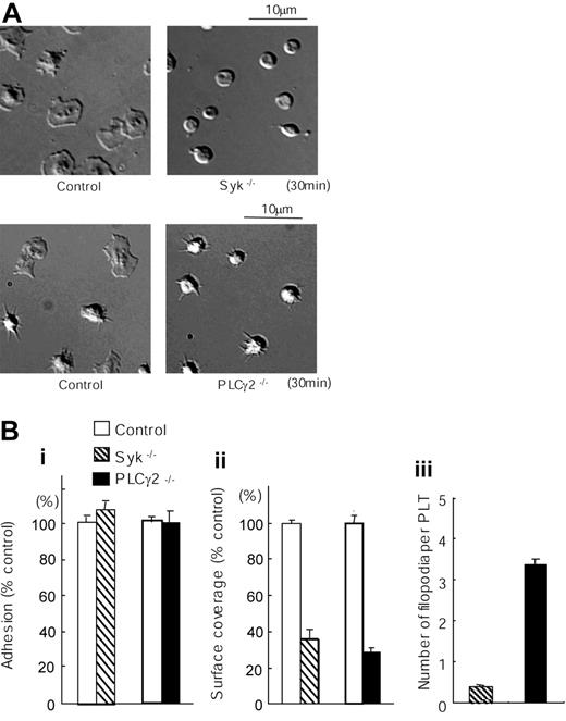 Figure 2. Spreading but not adhesion of mouse platelets on laminin is dependent on Syk and PLCγ2. (A) Washed murine platelets (3 × 107/mL) from control, Syk-deficient (Syk-/-), or PLCγ2-deficient (PLCγ2-/-) mice were pretreated with the αIIbβ3 blocker, lotrafiban (10 μM), before seeding on laminin-coated coverslips as described in Figure 1. Real-time imaging was performed using videomicroscopy with DIC optics. (B) (i) The number of adherent platelets was counted. The graph illustrates the mean number of percent wild-type adhesion ± SEM per image from at least 4 different images from 2 separate experiments. (ii) Total surface coverage of adherent platelets on laminin was measured using NIH image software. The graph illustrates the percent wild-type surface coverage ± SEM per image from at least 4 different images from 2 separate experiments. (iii) Number of filopodia-like projections in adherent platelets was counted. The graph illustrates the mean number of filopodia-like projection ± SEM per adherent platelet of at least 240 platelets from 2 separate experiments.