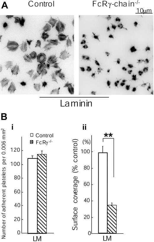 Figure 3. Spreading but not adhesion of mouse platelets on laminin is dependent on FcR γ chain. (A) Washed murine platelets (3 × 107/mL) from control or FcR γ chain–deficient mice (FcR γ chain-/-) were pretreated with or without 1 mM GRGDS peptide. Coverslips were coated with 50 μg/mL laminin and blocked with fatty acid–free BSA as described in Figure 1. BSA-coated coverslips were used for negative control. GRGDS-treated platelets were seeded on BSA- or laminin-coated coverslips for 30 minutes at room temperature. After unbound platelets were removed, platelets were fixed, stained, and photographed as described in Figure 1. (B) (i) The number of adherent platelets was counted. The graph illustrates the mean number of adherent platelets ± SEM per 0.006 mm2 from at least 8 different images from 3 separate experiments. (ii) Total surface coverage of adherent platelets on laminin-coated surfaces was measured. The graph illustrates the percent wild-type surface coverage ± SEM per 0.006 mm2 from at least 8 different images from 3 separate experiments. **P < .01.
