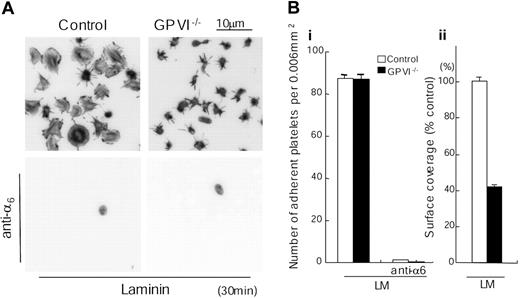 Figure 4. Spreading but not adhesion of mouse platelets on laminin is dependent on GPVI. (A) Washed murine platelets (3 × 107/mL) from control or GPVI-deficient mice (GPVI-/-) were pretreated with or without 1 mM GRGDS peptide in the presence or absence of 20 μg/mL anti–integrin α6 antibody. Laminin-coated coverslips were prepared as described in Figure 1. Platelets were seeded on laminin-coated coverslips for 30 minutes at room temperature. Adherent platelets were fixed, permeabilized, stained, and photographed using fluorescent microscopy as described in Figure 1. (B) The number of adherent platelets (i) and total surface coverage of adherent platelets on laminin (ii) were from at least 10 different images from 2 separate experiments.