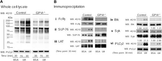 Figure 5. Laminin-induced protein phosphorylation is dependent on GPVI. Washed murine platelets (4 × 108/mL) from control or GPVI-deficient mice (GPVI-/-) were pretreated with 1 mM GRGDS peptide prior to adhesion to laminin as described in Figure 1. BSA-coated dishes were used for negative control; 300 μL of washed platelets were seeded on dishes for the indicated times at room temperature prior to stopping the reaction by addition of 300 μL of 2 × lysis buffer. (A) Proteins were separated by 6% to 20% gradient SDS-PAGE and protein-tyrosine phosphorylation visualized by Western blotting with 4G10. Protein loading was measured by Western blotting with anti-PLCγ2 pAb. (B) Fc receptor γ chain (i), SLP-76 (ii), LAT (iii), Btk (iv), Syk (v), or PLCγ2 (vi) were isolated by immunoprecipitation using specific antibodies before blotting with 4G10. Gels were reprobed with the antibody that was used in the immunoprecipitation studies. Tyrosine phosphorylation of Syk and PLCγ2 were quantified using Quantity One software for Macintosh. Optical density measurements were standardized by the recruitments of these proteins. The optical densities are shown above the corresponding lanes. The results are representative of 2 experiments.