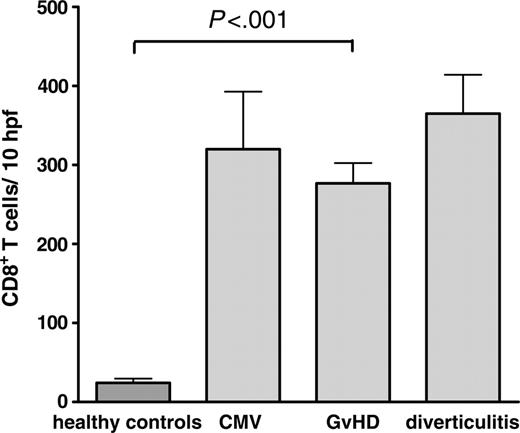 Figure 1. Comparison of the number of CD8+ T cells per 10 hpf's in intestinal biopsies. Paraffin-embedded colon biopsies of healthy controls (n = 13), and patients after allogeneic transplantation with GvHD (n = 62; chronic GvHD, n = 18; acute GvHD, n = 44), CMV-colitis (n = 6), and diverticulitis (n = 6) were stained for CD8 by immunohistochemistry. The number of CD8+ cells was counted per 10 high-power fields. Results are expressed as mean ± SEM. The differences of CD8+ T cells in GvHD, CMV, and diverticulitis were not statistically significant.