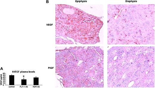 Figure 5. Circulating and local VEGF/P1GF levels correlate with ALL progression. (A) FLT-1 neutralization reduces the levels of circulating human VEGF plasma levels in NOD-SCID mice inoculated with 697 ALL cells. Results show a significant decrease (P < .05) in human VEGF levels (ELISA) in the plasma of NOD-SCID mice inoculated with the 697 cell line (after 10 days) and treated every other day with the FLT-1-neutralizing Ab 6.12 (FLT-1 Ab, 500 ng/injection). These results were obtained in 3 independent experiments. (B) VEGF and PlGF accumulate in the epiphysis of long bones of normal (nonleukemic) NOD-SCID mice, littermate controls of mice used in all the other experiments described in this paper. Images (at × 200 magnification) show BM sections, localized to the diaphysis or epiphysis, stained with mVEGF- and mPlGF-specific Abs. Note the clear accumulation of VEGF and PlGF (brown staining) close to the epiphyseal regions of the bone, whereas the diaphysis shows little evidence for VEGF or PlGF staining. Results shown were obtained from 2 independent determinations, done in animals of different ages. Error bars indicate standard deviation. Image acquisition performed as for Figure 3.