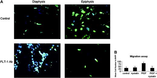 Figure 6. In vivo evidence and molecular basis for leukemia movement within bone marrow. (A) FLT-1 neutralization reduces actin polymerization in leukemia cells within the BM of inoculated NOD-SCID mice. Top panels (× 630 magnification) show BM sections of control (untreated) NOD-SCID mice 10 days after leukemia cells inoculation, stained and visualized in a fluorescence microscope as described in “Materials and methods.” Green staining shows leukemia cells with evidence for polarization/movement (Phalloidin, stains polymerized actin). Note the almost complete absence of Phalloidin staining in the epiphyseal regions of BM of mice treated with the 6.12 FLT-1-neutralizing Ab (FLT-1Ab, bottom panels, × 630 magnification). These results were obtained from 3 independent experiments. (B) Nystatin, a cholesterol-sequestering agent that impedes lipid raft formation, blocks P1GF-induced leukemia-cell migration. Results show transwell migration assay data, demonstrating that 697 cell migration (mean cell number in 6 HPF, × 400) in response to P1GF (10 ng/mL) is significantly (P < .05) impeded by cotreatment with nystatin, used as described in “Materials and methods.” Results shown are representative of 2 independent experiments. Error bars depict the standard error of the mean.