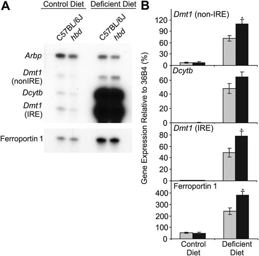 Figure 4. The expression of iron transport genes in the duodenum of hbd and wild-type mice. Duodenal expression of Dmt1 (both the IRE and non-IRE splice variants), Dcytb, and ferroportin 1 mRNA in wild-type () and hbd (▪) mice on either a control or iron-deficient diet was determined by ribonuclease protection assay. The mRNA encoding ribosomal protein Arbp was used as a normalization control. (A) Representative assays for each gene. (B) Band intensities for each gene were measured by densitometry and graphed as a proportion of 36B4 expression. The data represent the mean ± SEM (n = 5-11; *P < .05).