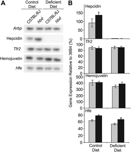 Figure 5. The expression of iron regulatory genes in the liver of hbd and wild-type mice. Hepatic expression of hepcidin, Tfr2, hemojuvelin, and hfe mRNA in wild-type () and hbd (▪) mice on either a control or iron-deficient diet was determined by ribonuclease protection assay. The mRNA encoding ribosomal protein Arbp was used as a normalization control. (A) Representative assays for each gene. (B) Band intensities for each gene were measured by densitometry and graphed as a proportion of 36B4 expression. The data represent the mean ± SEM (n = 5-11; *P < .05; **P < .01).