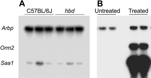 Figure 6. The expression of genes induced by inflammation in the liver of hbd and wild-type mice. The hepatic expression of Saa1 (induced in acute inflammation) and Orm2 (induced in both acute and chronic inflammation) mRNA in wild-type and hbd mice on control diet was determined by ribonuclease protection assay. The mRNA encoding ribosomal protein Arbp was used as a normalization control. (A) A representative gel is shown (16 hours of exposure). Note that Orm2 mRNA could not be detected in these animals. (B) RNA extracted from 4-week-old C57BL/6J mice that were either untreated or had been injected with Freund complete adjuvant 16 hours earlier was used to show the induction of the genes during acute inflammation (2 hours of exposure). No evidence of inflammation was observed in any hbd mouse tested (n = 9).