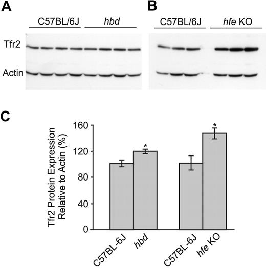Figure 7. The expression of Tfr2 protein in the liver of hbd and wild-type mice. (A) The hepatic expression of Tfr2 protein in wild-type and hbd mice on the control diet was determined by Western blotting. Actin was used as a loading control. (B) Protein extracted from the liver of 10-week-old C57BL/6J mice and hfe knockout (hfe KO) mice was used to demonstrate the increase in Tfr2 protein expression that occurs when the serum transferrin saturation is high. (C) Band intensities for each gene were measured by densitometry and normalized to actin expression before being graphed as a percentage of controls. The data represent the mean ± SEM (n = 3-4; *P < .05).