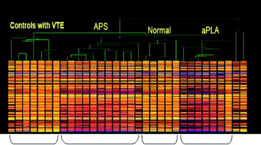 Figure 1. Patterns of gene expression that characterize clinical phenotypes. Hierarchical clustering of the initial patient samples based on gene-expression patterns. Each gene is represented by a single row, and each sample is represented by a single column. The color heat map represents genes in a graded fashion along a spectrum of activation, extending from strongly up-regulated genes in red to the down-regulated genes in blue.