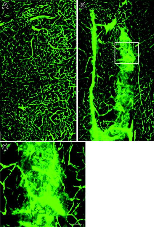 Figure 3. Cerebral microvessels perfused with FITC-dextran. The plasma-demarcated capillary networks show a broad array of twists, turns, and junctions in the striatum from a control mouse (A). Irregularly dilated cerebral microvessels with leakage of FITC-dextran was detected in the striatum of an SS mouse (B, C). Panel C is a high magnification of boxed area in panel B (Bar = 40 μm).
